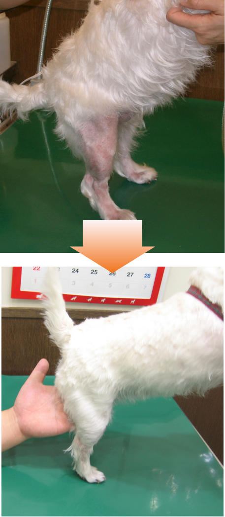 症例2のビフォーアフター写真