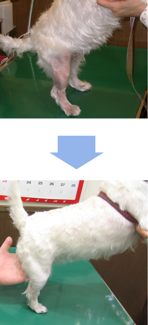 症例1のビフォーアフター写真