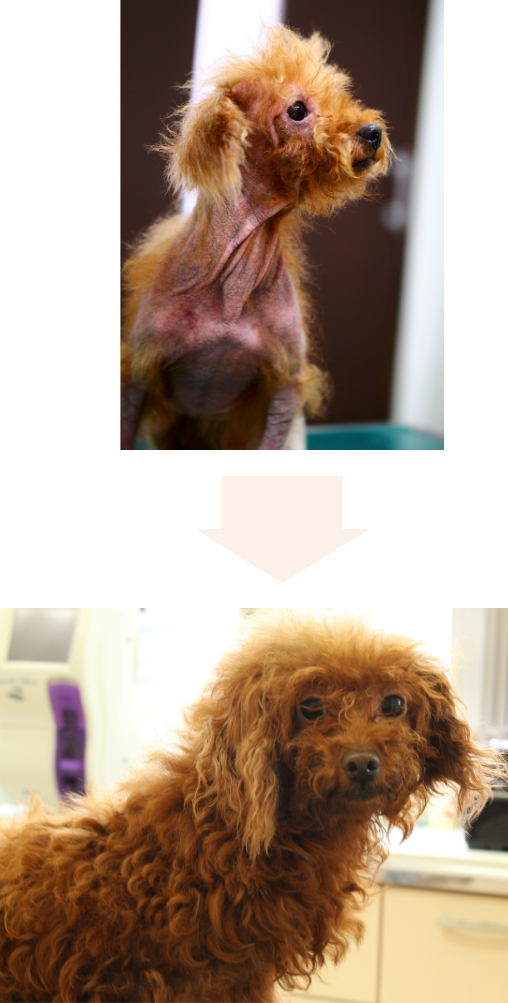 症例1のビフォーアフター写真