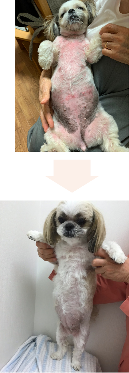 症例2のビフォーアフター写真