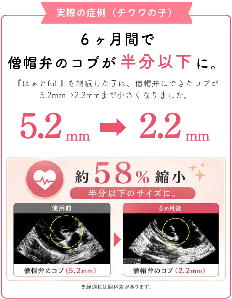 実際の症例で僧帽弁のコブが5.2mmから2.2mmに変化した記録