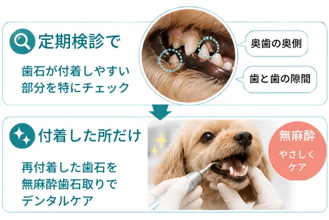 定期検診で歯石が付きやすい部分を確認し、付着した所だけ無麻酔でケア